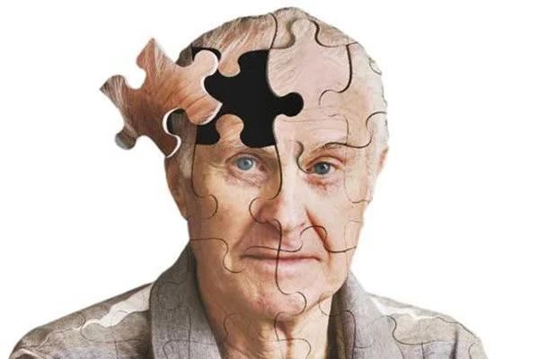 آلزایمر یکی از شایع‌ترین بیماری‌های سالمندان است.