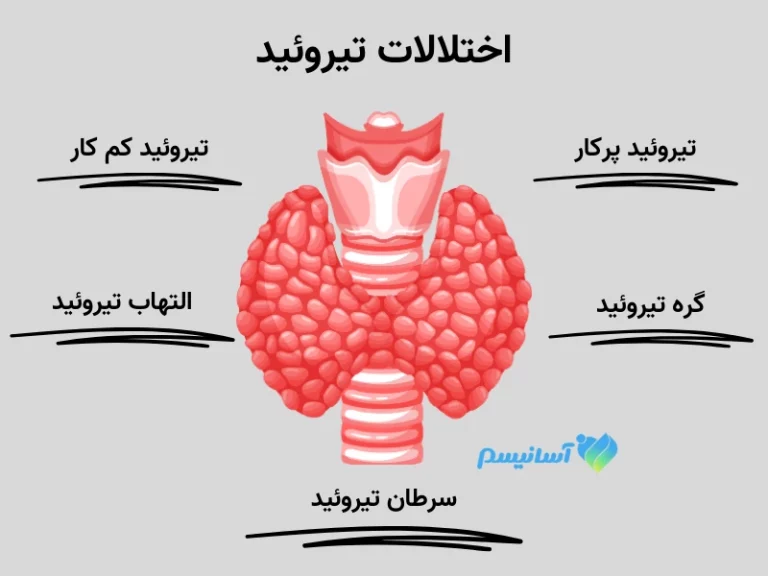 انواع اختلالات تیروئید در بدن