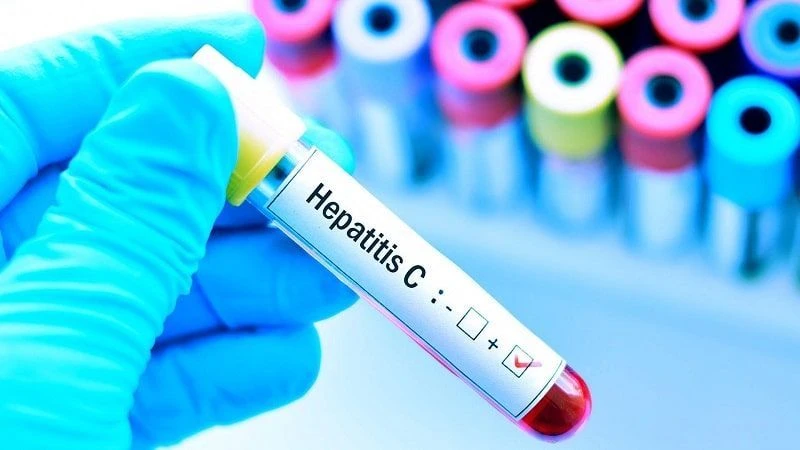 تست خون برای تشخیص هپاتیت