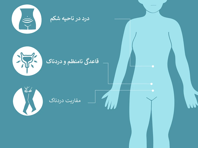 3 تا از علائم کیست تخمدان